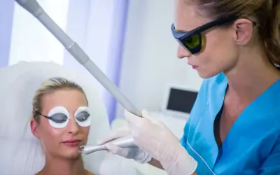 Chemical Peels vs Laser Treatment